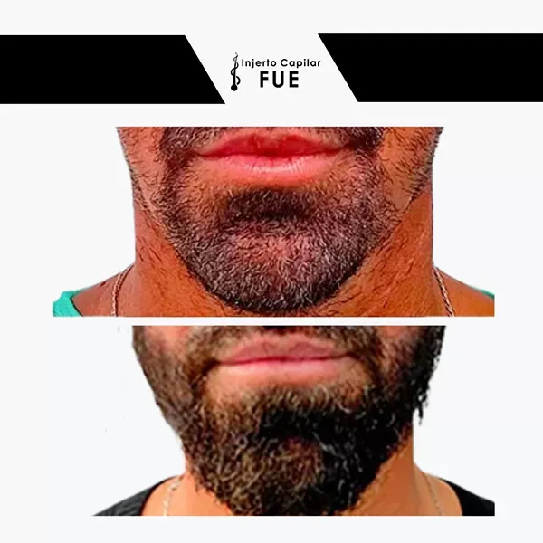 Antes y después de un tratamiento en la clínica