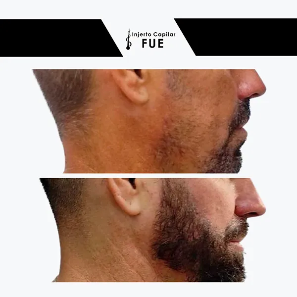 Antes y después de un tratamiento en la clínica