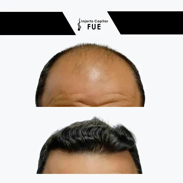 Antes y después de un tratamiento en la clínica