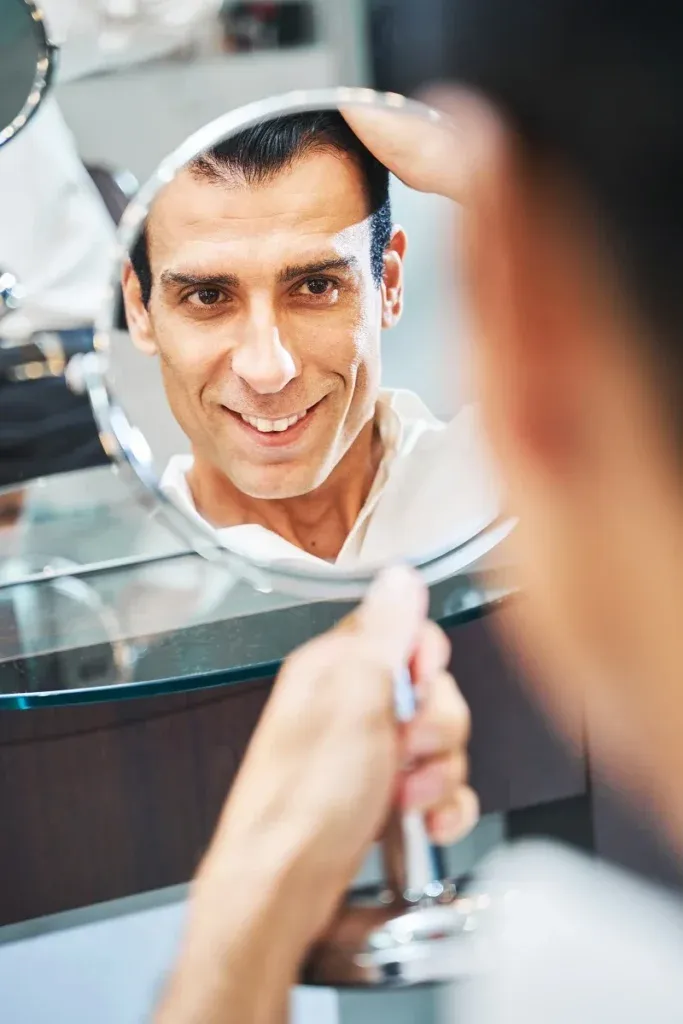 hombre observando la pérdida de cabello en el espejo antes de cirugía capilar FUE en Málaga
