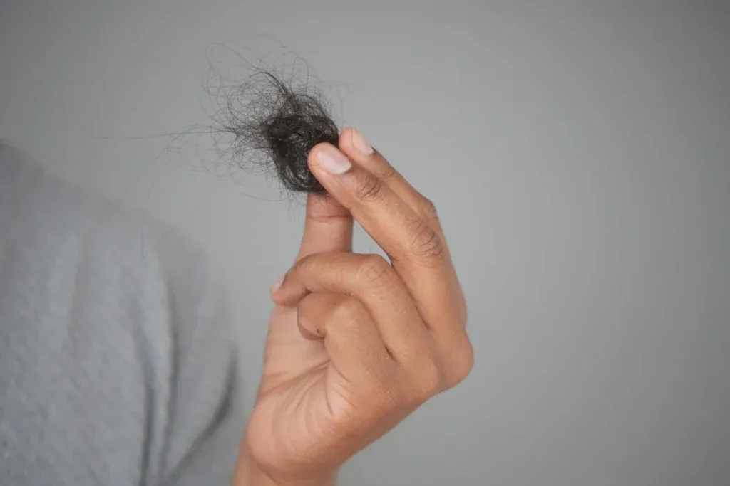 Alopecia por estrés: síntomas, causas y cómo recuperar el cabello perdido