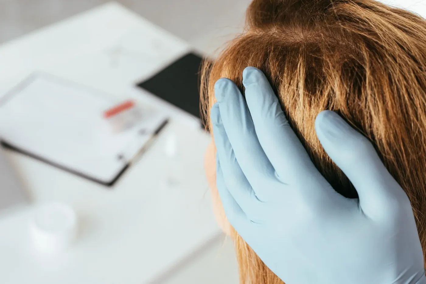 Tricoscopia capilar: qué es, para qué sirve y cómo ayuda a diagnosticar la alopecia